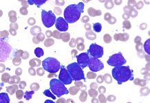 Ученые нашли новый подход к подавлению острой лейкемии