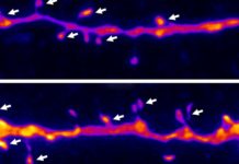 Создан новый тип лекарств на основе кетамина