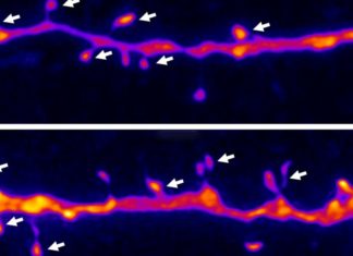 Создан новый тип лекарств на основе кетамина