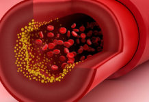 Яйца и холестерин обладают лучшим сочетанием, чем думают диетологи