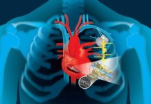 Создано устройство, добывающее энергию из биения сердца