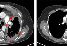 Представлена новая система диагностики рака DOLPHIN