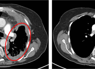 Представлена новая система диагностики рака DOLPHIN