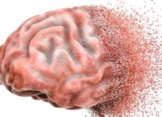 Выявлена взаимосвязь между АДТ-терапией и нейродегенерацией