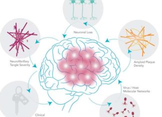 Лечение Альцгеймера световой терапией дает результаты