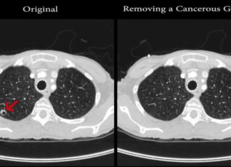 Ученые научились удалять узлы на сканировании