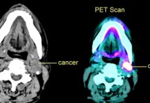 Разработан способ программно изменять снимки сканов