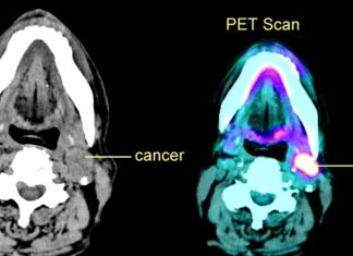 Разработан способ программно изменять снимки сканов