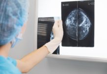 Новый тип иммунотерапии лечит рак груди