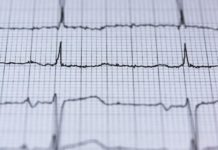 Apple готовит новую систему по регуляции кровяного давления