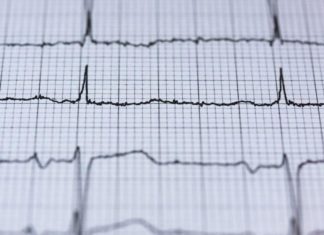 Apple готовит новую систему по регуляции кровяного давления