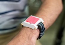 Созданы специальные наручные часы для аллергиков