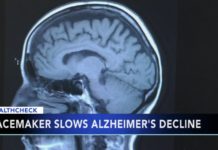 Представлен новый электростимулятор для мозга