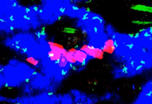 Новое исследование объясняет возможности иммунной системы подавлять рак