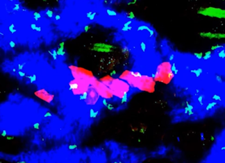 Новое исследование объясняет возможности иммунной системы подавлять рак