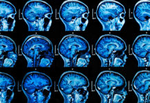 Депривация сна может усиливать боли