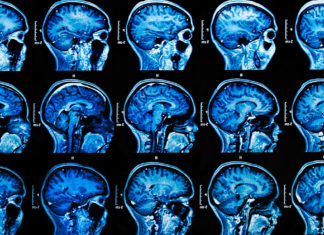 Депривация сна может усиливать боли