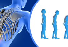 Найден новый подход к лечению остеопороза