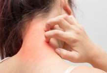 Новое лекарство против экземы демонстрирует успех