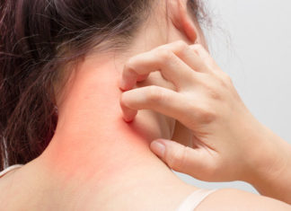 Новое лекарство против экземы демонстрирует успех