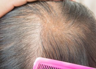 Ученые нашли способ остановить потерю волос