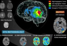 Раковые клетки лучше развиваются в жестких тканях: исследование