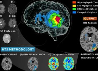 Раковые клетки лучше развиваются в жестких тканях: исследование