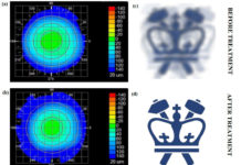 Представлен неинвазивный метод лечения миопии