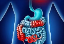 Популярное лекарство от давления может приводить к заболеваниям кишок