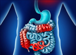 Популярное лекарство от давления может приводить к заболеваниям кишок