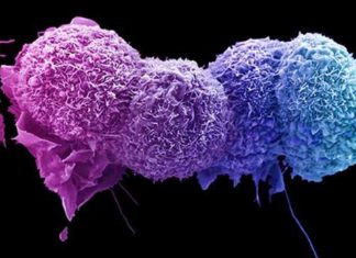 Рак может развиваться, изменяя кишечный микробиом человека