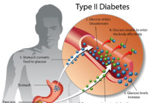 Обнаружен новый триггер сахарного диабета второго типа