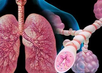 Выявлена диета, облегчающая симптомы астмы