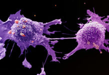 Собаки могут учуять следы раковых клеток в крови