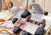 В США одобрена новая система фильтрации крови