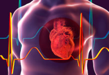 Популярное лекарство при диабете помогает защититься от риска инфаркта