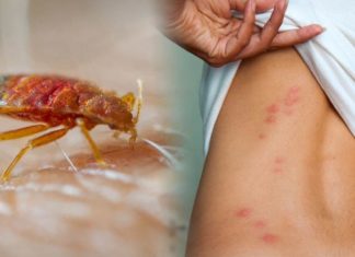 Как быстро уничтожить клопов в Ижевске