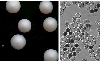 Колонии дрожжей могут защитить от сильных доз радиации