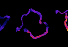 Кишечные молекулы и ранняя смерть – что общего?