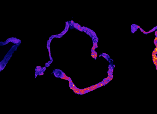 Кишечные молекулы и ранняя смерть – что общего?