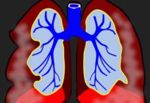 Риск развития рака значительно увеличивается у людей, ведущих пассивный образ жизни