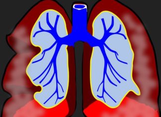 Риск развития рака значительно увеличивается у людей, ведущих пассивный образ жизни