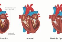 Израильские ученые разработали приложение, диагностирующее проблемы с сердцем