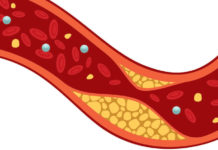 Высокий холестерин может быть обязан не жирам, а углеводам