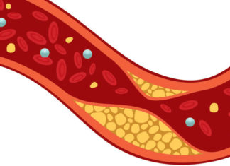 Высокий холестерин может быть обязан не жирам, а углеводам
