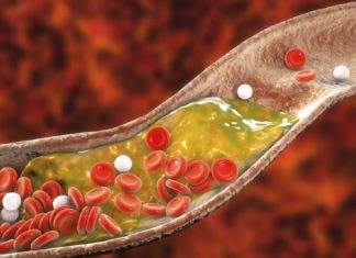 Разницы между HDL и LDL-холестерином для здоровья сердца не существует