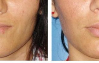 Увеличение губ и прочие услуги от лучшей киевской клиники