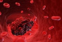 Вакцина от J&J расследуется в связи с тромбами