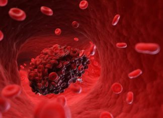 Вакцина от J&J расследуется в связи с тромбами